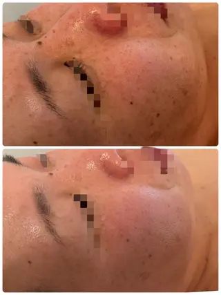 メナード　フェイシャルサロン　鳥飼野々店所属・石川 捺季のエステ・リラクイメージ