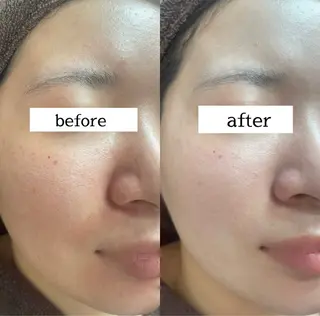 浮腫|肩こり|張り 日々の疲れを解消⭐️のエステ・リラクイメージ