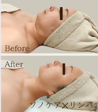 美肌脱毛＆小顔・フェ イシャル【SONA】のエステ・リラクイメージ