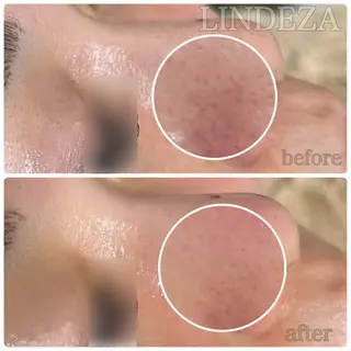 private salon 𝐋𝐈𝐍𝐃𝐄𝐙𝐀所属・LINDEZA Ayaのエステ・リラクイメージ