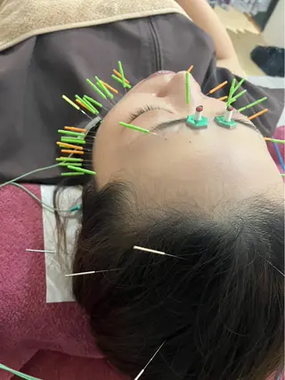 美容鍼灸女性専用 りんご鍼灸治療院のエステ・リラクイメージ
