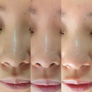  毛穴洗浄・まつ毛 の専門店 ソラーレのエステ・リラクイメージ