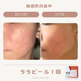 aimer beautyのエステ・リラクイメージ