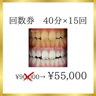 メンズ キッズ ホワイトニング ショップ多摩店のその他イメージ