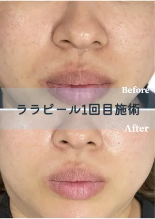 徳山 まみのエステ・リラクイメージ