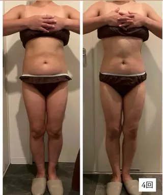 痩身/フェイシャル 💓KOUMA💓のエステ・リラクイメージ