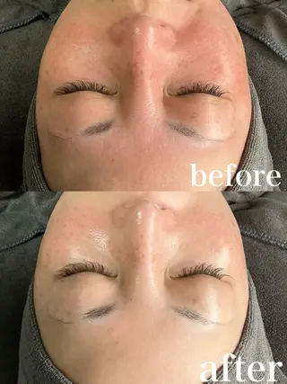 a.spa＆herb所属・a.spa&herb 船橋北口店のエステ・リラクイメージ