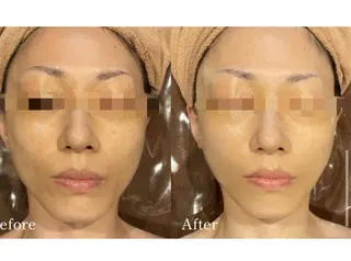 Total Beauty salon Bloom所属・肌育WISHpro 専門サロンBloomのエステ・リラクイメージ