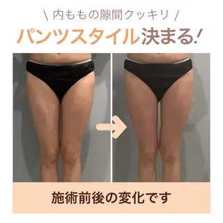 エステサロン JURISのエステ・リラクイメージ