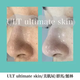 ULT ultimateskin所属・ULT ウルトのエステ・リラクイメージ