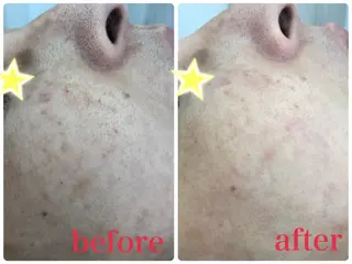 宮野 麻綺のエステ・リラクイメージ