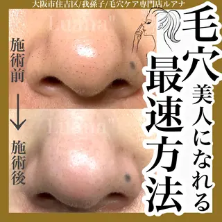 eyelash salon Luana所属・Luana 【ルアナ】小山のエステ・リラクイメージ