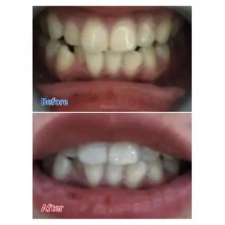 M渋谷店所属・Ｍ渋谷 ホワイトニングのエステ・リラクイメージ