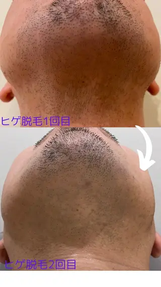 varyclue NORIKOのエステ・リラクイメージ