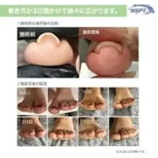 ネイル hiromi. ＊モデル募集＊のネイルデザイン