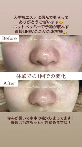 都度払い 肌質改善専門サロンのエステ・リラクイメージ