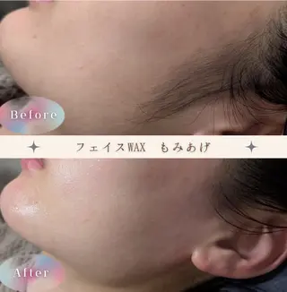 肌質改善プライベートサロンwith U所属・肌質改善サロン with Uのエステ・リラクイメージ