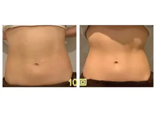 癒し腸もみサロン シャユーム　ゆきなのエステ・リラクイメージ