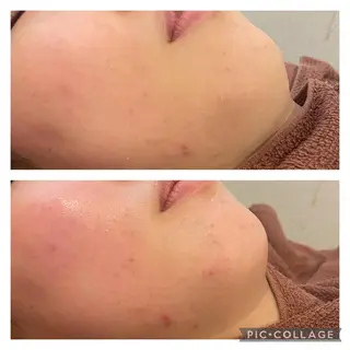 ミディアム カラー パーマ ヘアアレンジ メンズ キッズ ネイル マツエク・マツパ アイブロウ ニキビ特化型エステ 🍓最短で肌質改善のエステ・リラクイメージ