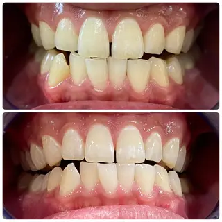 White Berry SELF BEAUTY SALON所属・セルフホワイトニング 🦷口元垢抜け✨のその他イメージ