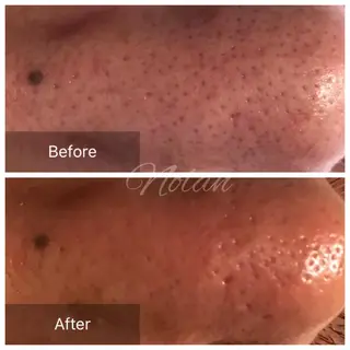 Morisugi Natsumiのエステ・リラクイメージ