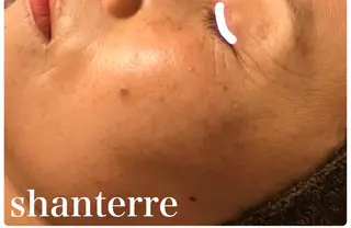 ピーリングサロン シャンテールのエステ・リラクイメージ