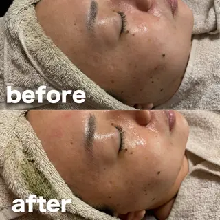 肌質改善 陶器肌🌿のエステ・リラクイメージ