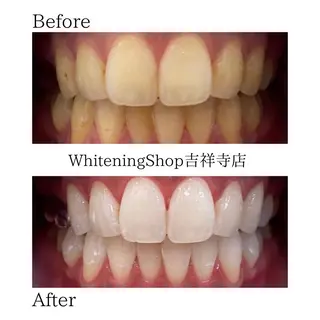 ホワイトニング ショップ吉祥寺店のエステ・リラクイメージ