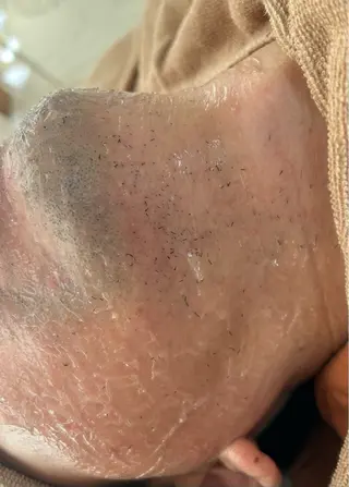 都度払い制脱毛サロンBe Charm所属・Be Charm 山﨑のエステ・リラクイメージ