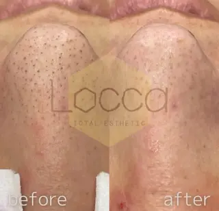 メンズ エステティック ロッカのエステ・リラクイメージ