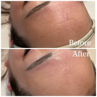 Nna Salon所属・Nna 🫧韓国肌管理🫧のエステ・リラクイメージ