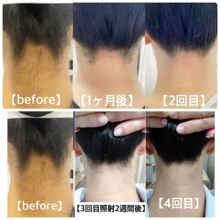 みんなの脱毛 TSURURINの眉毛・アイブロウイメージ