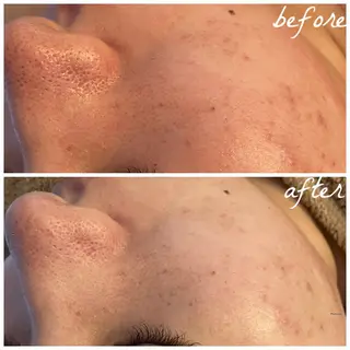 メンズ メナード岐阜市茜部 杉浦のエステ・リラクイメージ