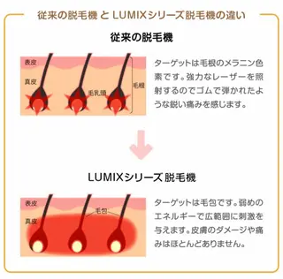 DISINI  SPA所属・DISINISPA 脱毛/フェイシャルのエステ・リラクイメージ