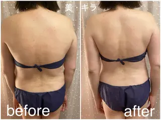 美・キラ ハイフ痩身&美肌のエステ・リラクイメージ