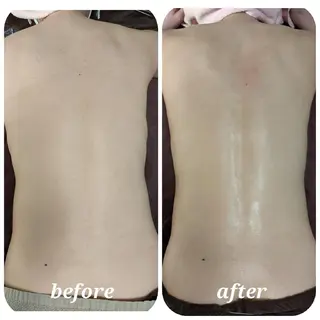 整体エステ　NEW ME所属・深層リンパオイル/小 顔とドライヘッドスパのエステ・リラクイメージ