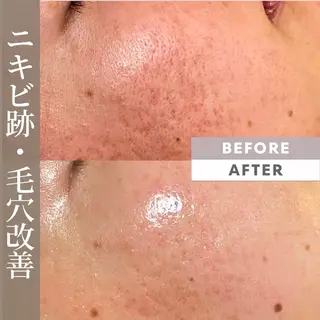 Ulu.肌質・体質改善専門サロン所属・後藤 真美のエステ・リラクイメージ