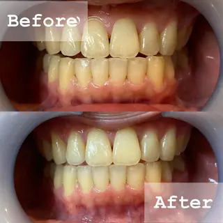 LBSホワイトニング 新宿店💝店長熊倉のエステ・リラクイメージ