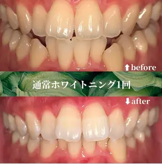 futaba ホワイトニング/天神のエステ・リラクイメージ