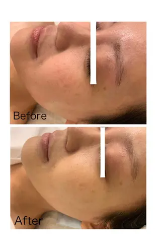 ナリスビューティサロンあべの所属・肌質改善/ツヤ肌作り /松本杏奈のエステ・リラクイメージ