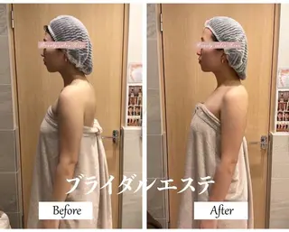 ブライダルサロン ｜Lino【堀江】のエステ・リラクイメージ