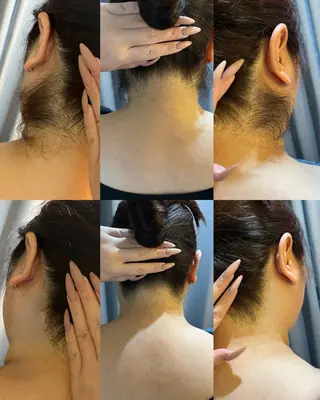 うなじ脱毛/美肌脱毛 LABELのエステ・リラクイメージ