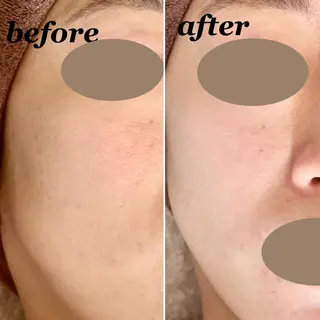 total beauty DIAのネイルデザイン