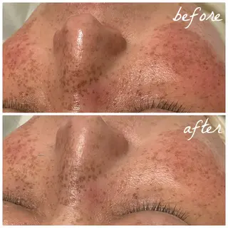 メンズ メナード岐阜茜部 杉浦のエステ・リラクイメージ