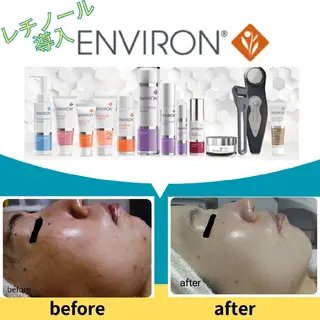 レチノール/ニキビ/ 毛穴ケア 浅川のエステ・リラクイメージ