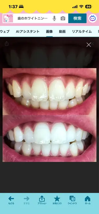 WHITENING ハウスのマツエク・マツパデザイン