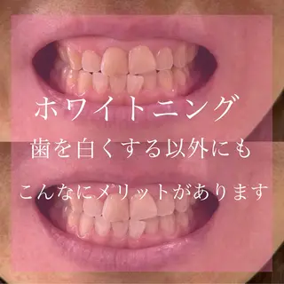 Livicate 💗🧁🎀🦋のマツエク・マツパデザイン