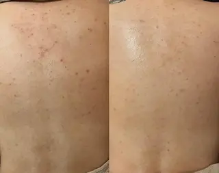 for woman所属・森 美優のエステ・リラクイメージ