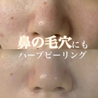 WHITE AQUA 北千住店のエステ・リラクイメージ