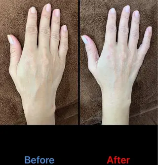 ネイル 毛穴改善/脱毛 ネイル　川上久仁子のエステ・リラクイメージ